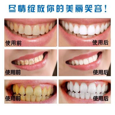 【2017新款】【高大上的选择】【东西很好有点贵】【质量保证】【一刷就白美白牙神器】【买2送1一疗程】亮白洗牙粉美白牙齿去黄牙渍烟渍牙垢结石美白牙齿除口臭刷牙粉牙膏50g牙斑净速效去除烟渍咖啡渍茶渍食物色素等引起的黑黄牙【牙齿护卫】