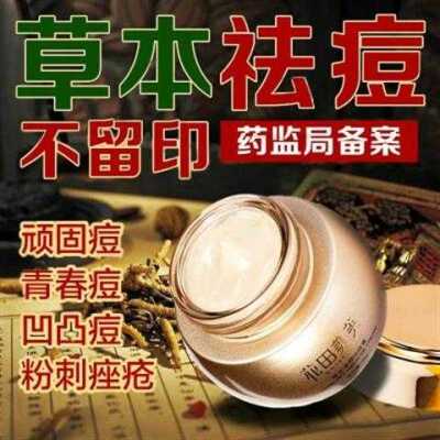 祖传中药祛痘膏男女士产品 升级版 学生 白天使祛痘霜 乳 液控油去痘印祛痘印膏去痘痘药膏青春痘痤疮药 膏粉刺草本螨虫膏