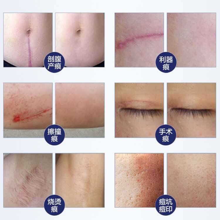 皮肤修复周期多少天 c4faae7a0e55c83a209bd05c43f397aa.jpeg